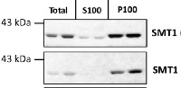 SMT1 | Sterol methyltransferase 1 in the group Antibodies Plant/Algal / Membrane Transport System / Endomembrane system at Agrisera AB (Antibodies for research) (AS07 266)